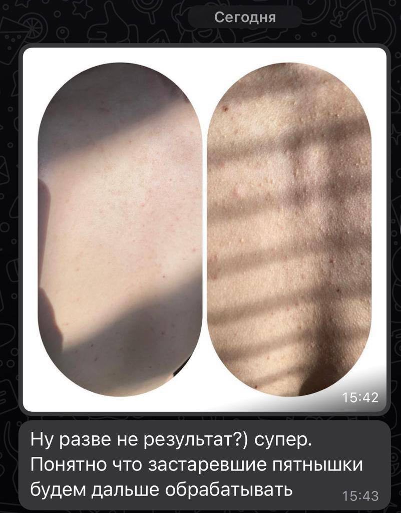 История успеха 8