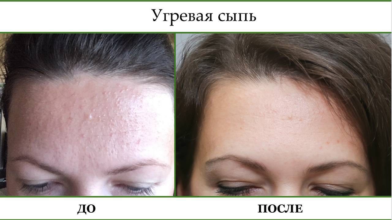 История успеха 5